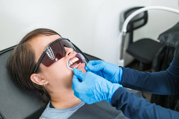 Best Teeth Whitening  in Lillian, AL
